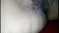 THE HAIRY OF LUPE