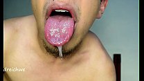 Ouvrir la bouche avec une grosse langue