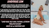 Sindy Rose self anal fisting & extreme prolapse on bed