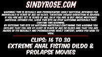 Sindy Rose extrema fisting anal, compilação de dildo e prolapso 16 a 30