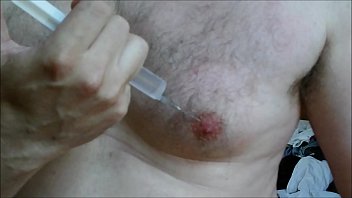 Nipples saline injection